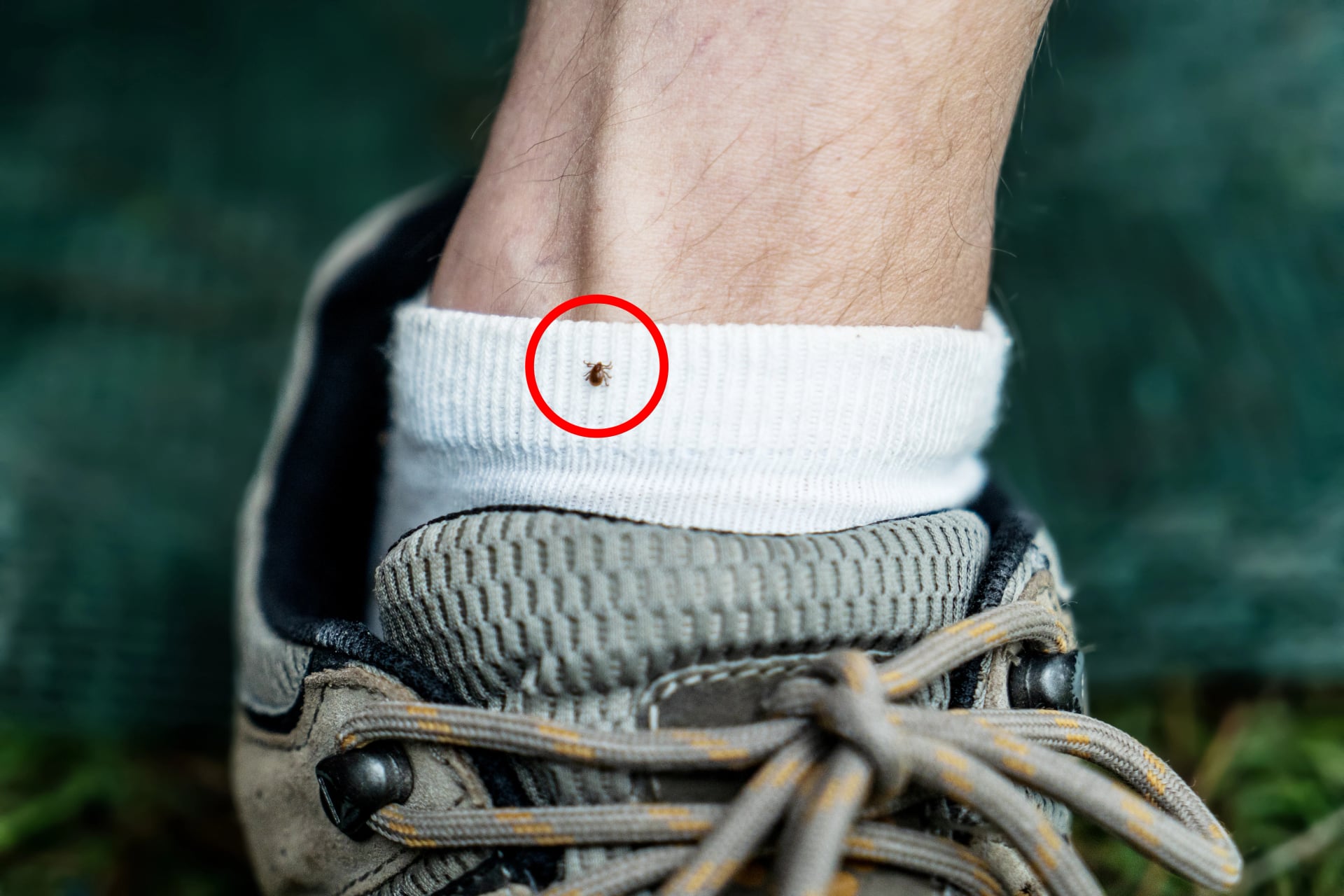 Australian bush tick sitting on a sog on a human leg. Cattle tick dangerous to human. Hiking